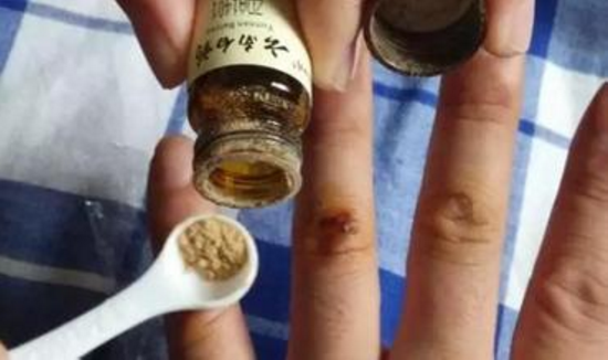 How Can Yunnan Baiyao Capsules Help Your Sick Dog? (2024 Updated)